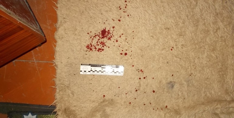 На Рівненщині тесть вдарив ножем зятя, бо не передав гроші на лікування дружини