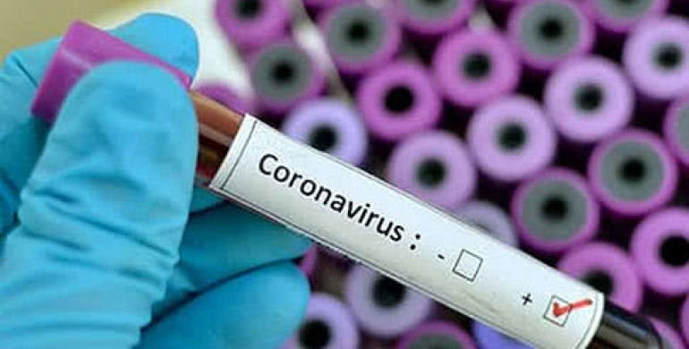 В Україні зафіксували перший випадок коронавірусу (ВІДЕО)