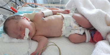 Рівненський журналіст просить допомоги на лікування новонародженої донечки