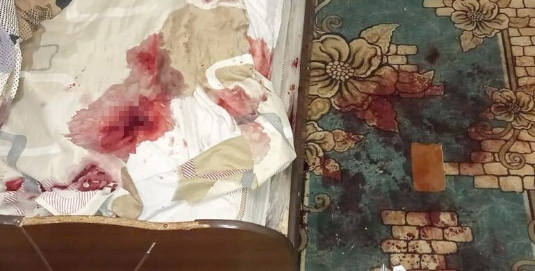 На Рівненщині після розпивання спиртного власник житла завдав ножових поранень гостю
