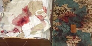 На Рівненщині після розпивання спиртного власник житла завдав ножових поранень гостю