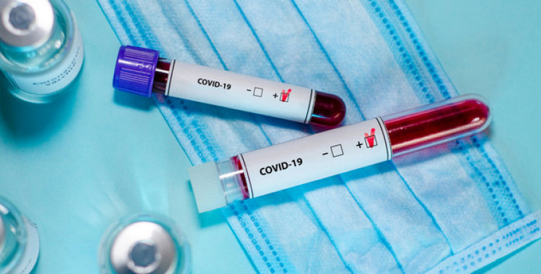 На Рівненщині +29 нових хворих коронавірусом