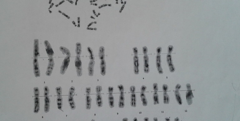 Рівненський діагностичний центр отримає нове обладнання для дослідження хромосом 