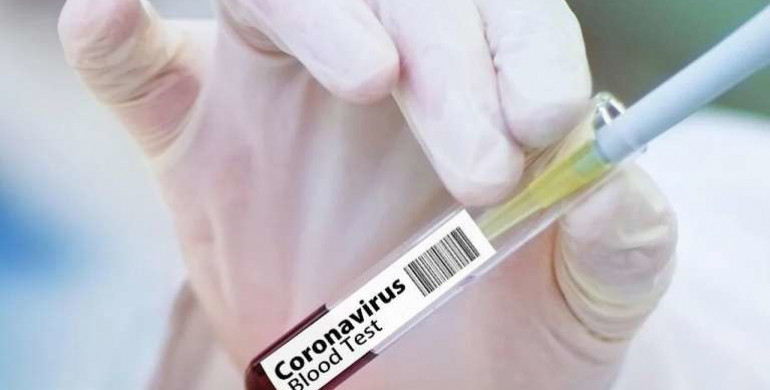 «Помаранчевий» рівень епідемічної небезпеки поширення COVID-19  встановили відучора на Рівненщині