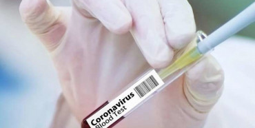 «Помаранчевий» рівень епідемічної небезпеки поширення COVID-19  встановили відучора на Рівненщині