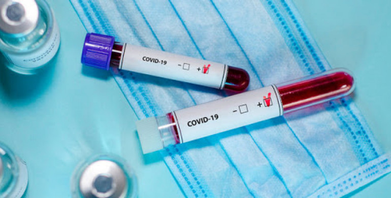 На Рівненщині 8 нових хворих коронавірусом та 457 перевіряють