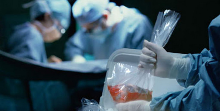Кабмін затвердив тарифи на трансплантацію органів