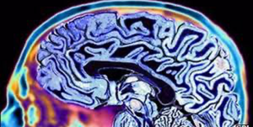 Науковці реконструювали почуту людьми музику за активністю мозку
