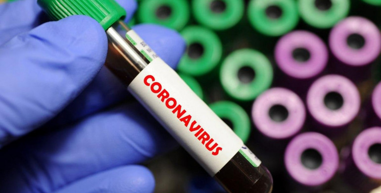 На Рівненщині за добу додався 1 новий хворий на коронавірус