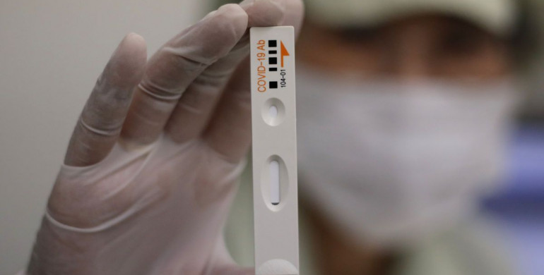 Україна розпочинає тестування на антитіла до коронавірусу: які області стануть першими
