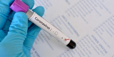 АНТИРЕКОРД: в Україні зафіксовано 2134 нові випадки коронавірусної хвороби COVID-19 