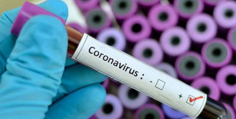 На Рівненщині 14 нових випадків захворювання коронавірусом