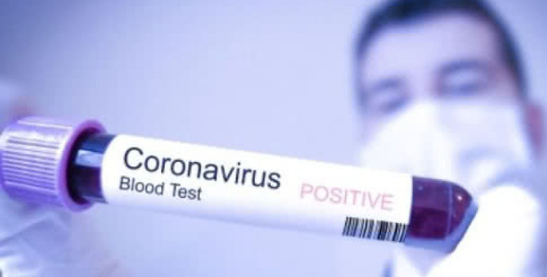 Уряд затвердив посилення карантинних заходів для стримання поширення коронавірусної хвороби в України