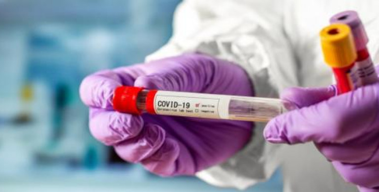 Рівненщина найбільше в Україні тестує на коронавірус