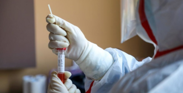 Ще сім випадків коронавірусу підтвердили у Рівному