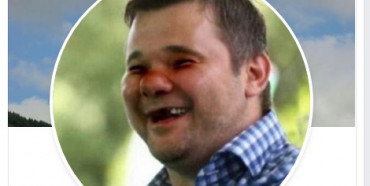 В мережі з’явилось фото Богдана з вибитими зубами і синцями (ФОТО)