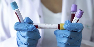 В Україні зафіксовано 2 нові випадки інфікування коронавірусом, – МОЗ