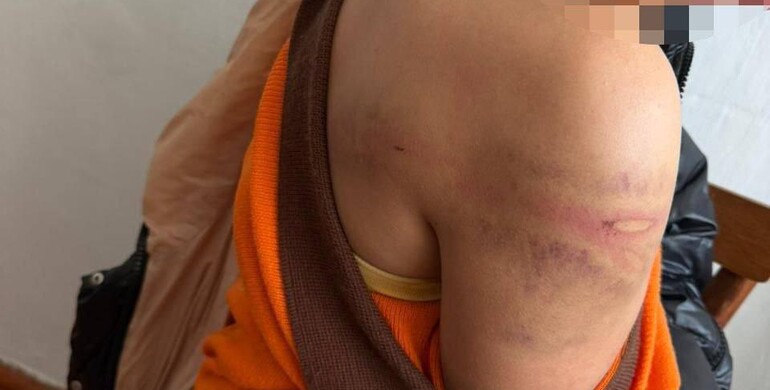 У Рівному судитимуть батька, який побив неповнолітню доньку 