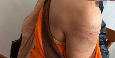 У Рівному судитимуть батька, який побив неповнолітню доньку 