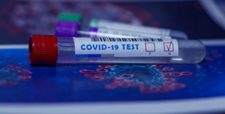 На Рівненщині зменшується кількість нових інфікувань COVID-19