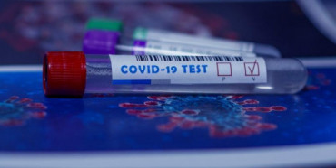 На Рівненщині зменшується кількість нових інфікувань COVID-19