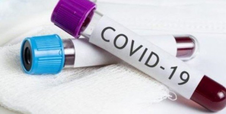 На Рівненщині збільшення хворих з COVID-19 на понад пів сотні