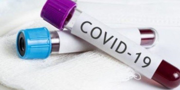 На Рівненщині збільшення хворих з COVID-19 на понад пів сотні