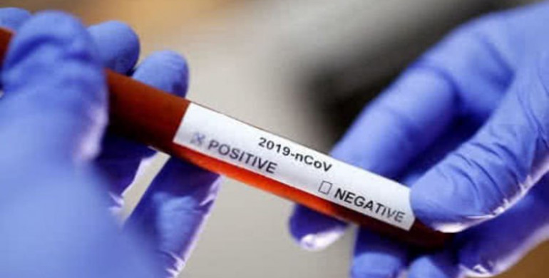 На Рівненщині 29 нових хворих коронавірусом, а 7 вже виписали з лікарень