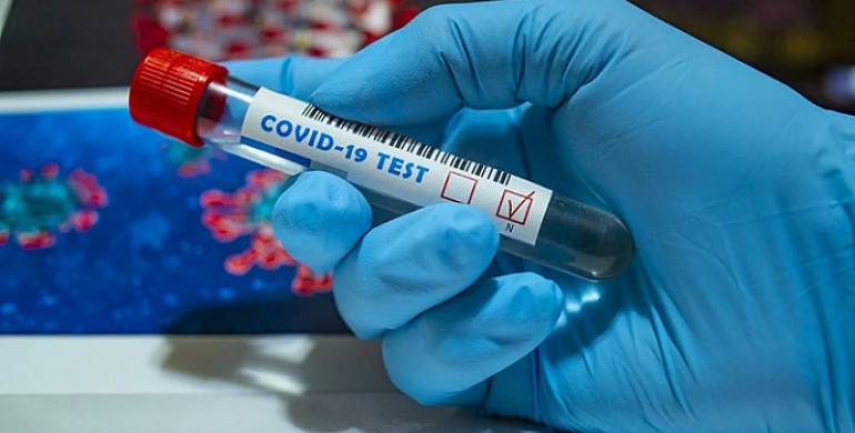В Україні за добу зафіксовано понад 11 тисяч COVID-інфікованих