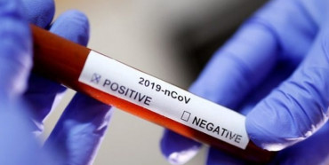 В Україні зафіксовано 1 433 нові випадки коронавірусної хвороби COVID-19