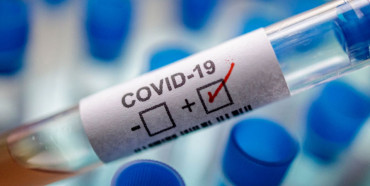 За ніч на Рівненщині майже три десятки нових хворих на COVID-19