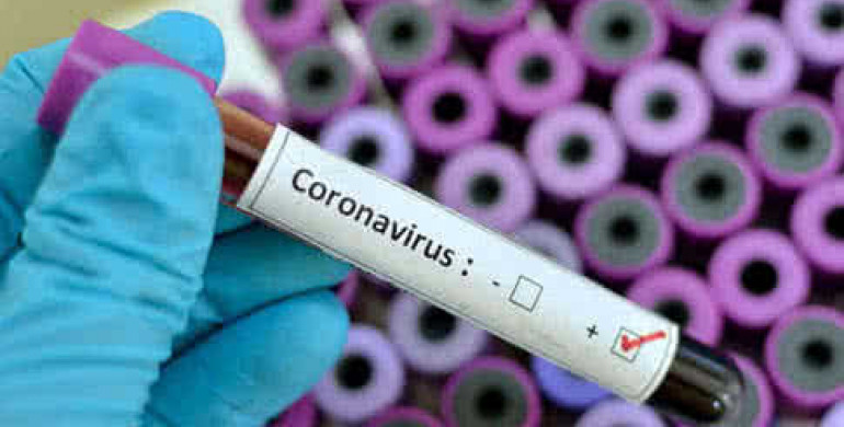 На Рівненщині за ніч зафіксували шість хворих коронавірусом