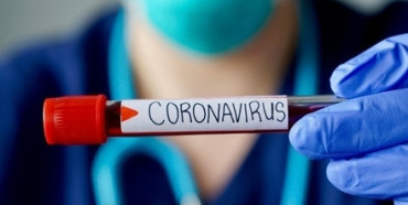 На Рівненщині підтверджено 54 нових випадки захворювання на COVID-19