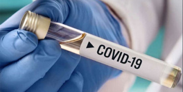На Рівненщині за добу 80 людей захворіли на COVID-19