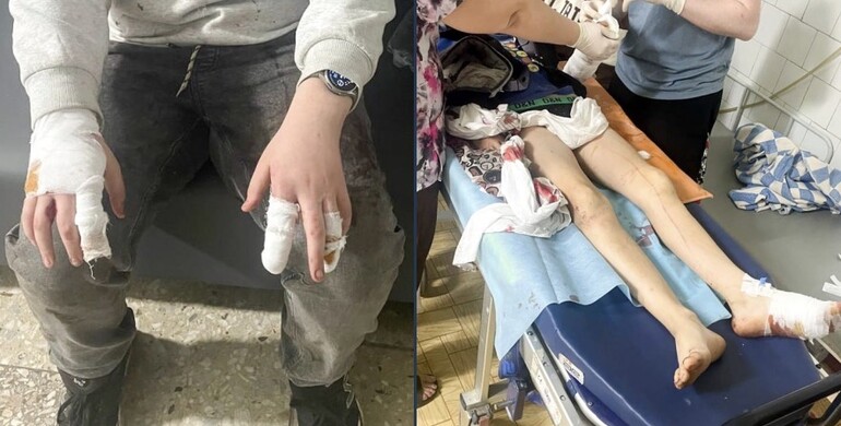 На Рівненщині охоронні собаки покусали малолітніх дітей