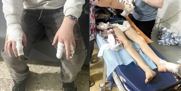 На Рівненщині охоронні собаки покусали малолітніх дітей