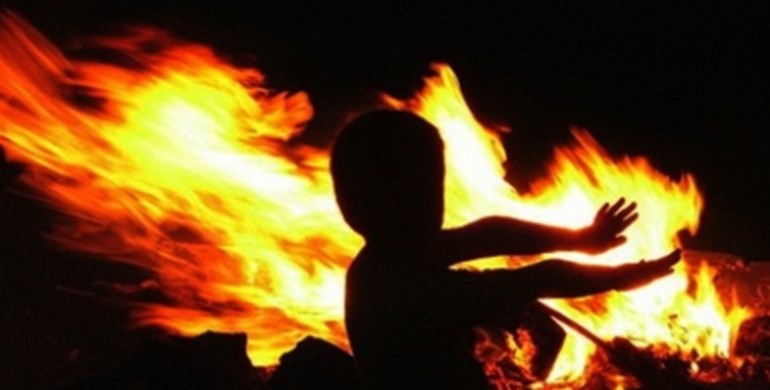 У Рівненській області обгоріла 2-річна дитина